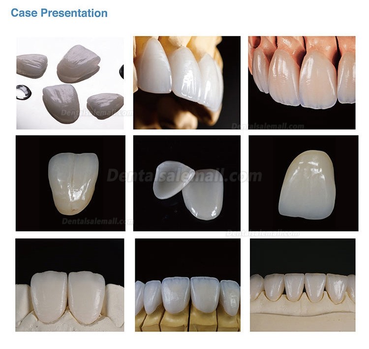 3Pcs/Box C14 Cad/Cam Lithium Disilicate Glass Ceramic Block for Dental Lab Veneer and Anterior Teeth Material